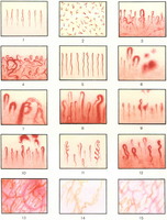 Ревматолог Ужгород – консультації та лікування суглобів