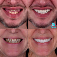 Стоматології Са-Ната: якісні стоматологічні послуги у Києві